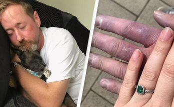 Man who thought his hands were ‘cold’ issues warning after being diagnosed with life-threatening condition