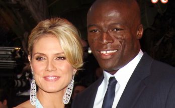 Why Singer Seal Has Scars on His Face - 3 Pics of What He Would Look Like without Them